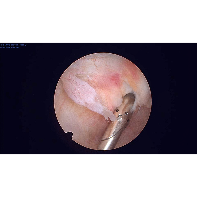 2,7 mm de artroscópio